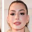 Caso Anne Hathaway: é possível fazer cirurgia plástica sem que ninguém perceba?