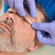 Blefaroplastia segura previne complicações graves