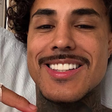 MC Livinho deixa 'Dança dos Famosos' após acidente de moto