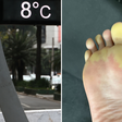 Saí de casa de chinelo nesse frio e meus dedos ficaram assim. Esse especialista explica o que aconteceu