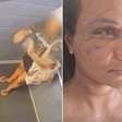 Vaquinha para mulher agredida com 61 socos em elevador chega a R$ 100 mil