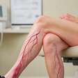 Saúde vascular: campanha alerta para cuidados