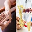 O corpo alerta para o Alzheimer muito antes do cérebro; a pista está no intestino