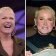 Xuxa surge com cabelos volumosos seis meses após transplante; veja antes e depois