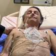 Bolsonaro corre risco de vida? Médico explica diagnóstico 'fatal' do ex-presidente