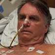 Atualização: Bolsonaro passará a noite no hospital após crise de soluço e vômitos
