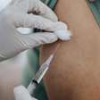 Empresa farmacêutica submete pedido de inclusão do 1º medicamento injetável que previne HIV no SUS