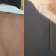 Ex-companheiro agride mulher com cabo de rodo durante conversa sobre filhos em Uberlândia