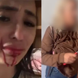 Imagens fortes! Ex-bailarina do Faustão é esfaqueada pela mãe usuária de crack: 'Tô cuspindo sangue'