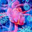 Miocardite: o que é, as causas, sintomas e tratamento