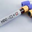Descoberta histórica pode ser início do fim do HIV: cientistas alemães encontram anticorpo capaz de neutralizar quase todas as variantes do vírus