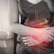 Isquemia intestinal: entenda a "falta de sangue no intestino"