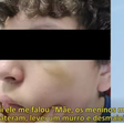 Adolescente brasileiro é agredido em escola em Portugal: 'Levei um murro e desmaiei'