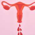 Menstruação abundante: entenda os sinais de alerta para sua saúde