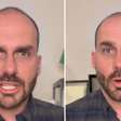 Eduardo Bolsonaro quebra o silêncio após perder mandato