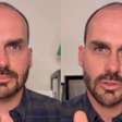Eduardo Bolsonaro se pronuncia pela primeira vez após cassação: 'Medalha de honra'