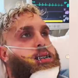 Jake Paul publica vídeo com a mandíbula fraturada após luta com Anthony Joshua