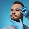 Rinoplastia está entre as 5 cirurgias mais procuradas por homens