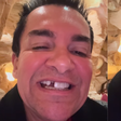 Regis Danese perde o dente e surpreende seguidores
