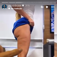 Yasmin Brunet perde 15 kg após tratamento do lipedema