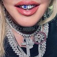 Preço de um carro? Madonna choca web com valor de joia no dente