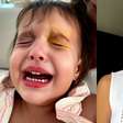 Menina de 2 anos tem corte na córnea durante brincadeira e mãe relata susto: 'Pode ficar cega?'