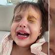 Menina de 2 anos tem corte na córnea durante brincadeira