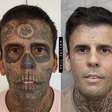 'Homem mais tatuado do Brasil' passa por sexta sessão de remoção a laser