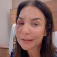 Como Ivete Sangalo está após cirurgia? Cantora explica quadro de saúde