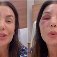 É grave? Ivete Sangalo precisa passar por cirurgia no rosto