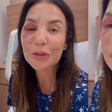 O que aconteceu com Ivete Sangalo? Cantora quebra dois ossos do rosto após desmaio, passa por cirurgia e surge inchada nas redes: 'Estou bem'