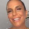 Não deu certo? Após cirurgia no rosto, Ivete Sangalo reclama: 'Dormência'
