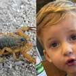Pai vê negligência e falha em atendimento ao filho de 3 anos morto após picada de escorpião: 'Gritava de dor'