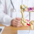 Fique atento: estes 5 sinais indicam câncer de intestino em estágio inicial