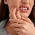 Cárie ou frio? Saiba o que pode estar por trás da dor nos dentes