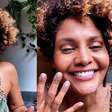 Bárbara Reis relata sinais ignorados por anos até descobrir lipedema: 'Achei que o problema era eu'