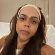 Igual à Anitta? Camila Loures faz cirurgia no rosto e revela detalhes de decisão