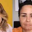Gente? Ana Paula Renault surge irreconhecível e inchada em vídeo antigo após procedimento estético; antes e depois viraliza: 'Pelo visto funcionou'