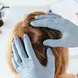 Caspa explicada: o que é, por que surge e como tratar com shampoos, hábitos e cuidados baseados em evidências médicas