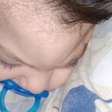 A história de Enzo e a busca por apoio para cirurgia