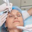 Blefaroplastia remodela pálpebras e rejuvenesce o olhar