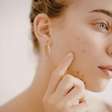 O fim da acne? Ciência testa vacina para combater a inflamação da pele; saiba tudo