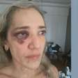 Passageira é agredida por motociclista de aplicativo após reclamar de capacete sem viseira no Rio