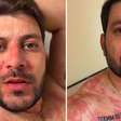 Ex-BBB Caio Afiune surge irreconhecível e vai ao hospital às pressas: 'Ofegante'