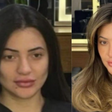 Veja o antes e depois do procedimento capilar que fez mulher esfaquear cabelereiro em SP