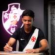 Vasco renova com Andrey Fernandes, joia de 18 anos