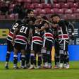 Inter de Limeira x Santa Cruz: onde assistir e prováveis escalações