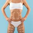Avanços tecnológicos ampliam resultados da lipoaspiração