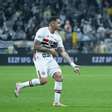 Juventude x São Paulo: Tricolor manterá vantagem? Veja odds