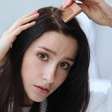 Caspa em adolescentes: por que ela aparece mais nessa fase?